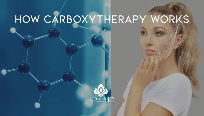 how-carboxytherapy-works
